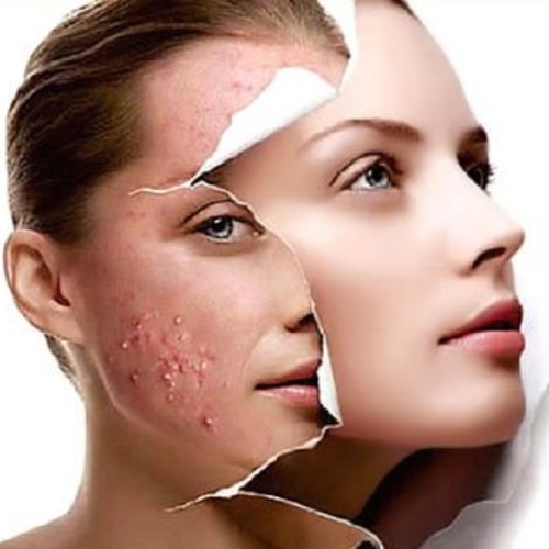 CHĂM SÓC SẮC TỐ CHUYÊN SÂU CÙNG HỒNG NHÂN HOME BEAUTY