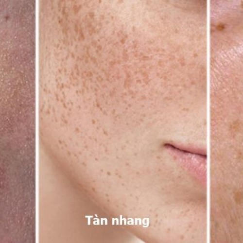 CÁC LIỆU TRÌNH NÁM - TÀN NHANG - ĐỒI MỒI