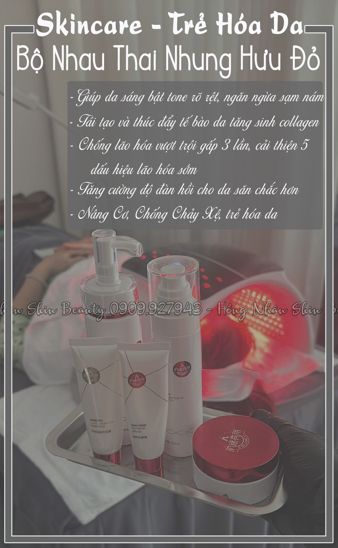 nhau thai nhung huu hns